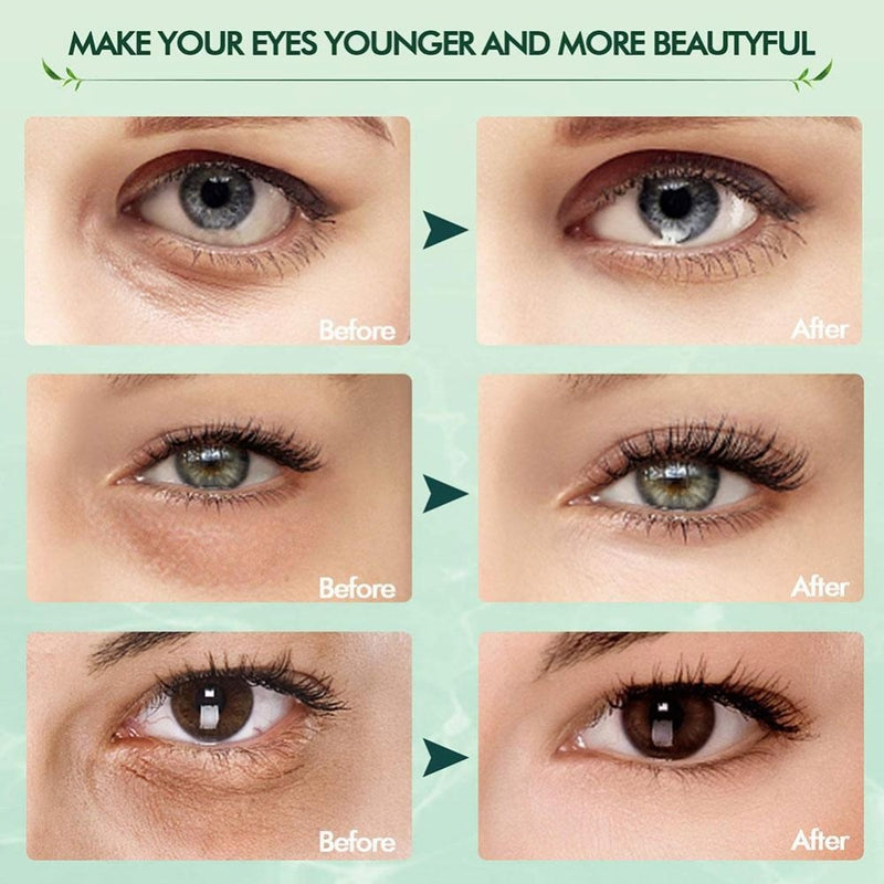 Anti-Age Bag Eye Wrinkle Skin Care