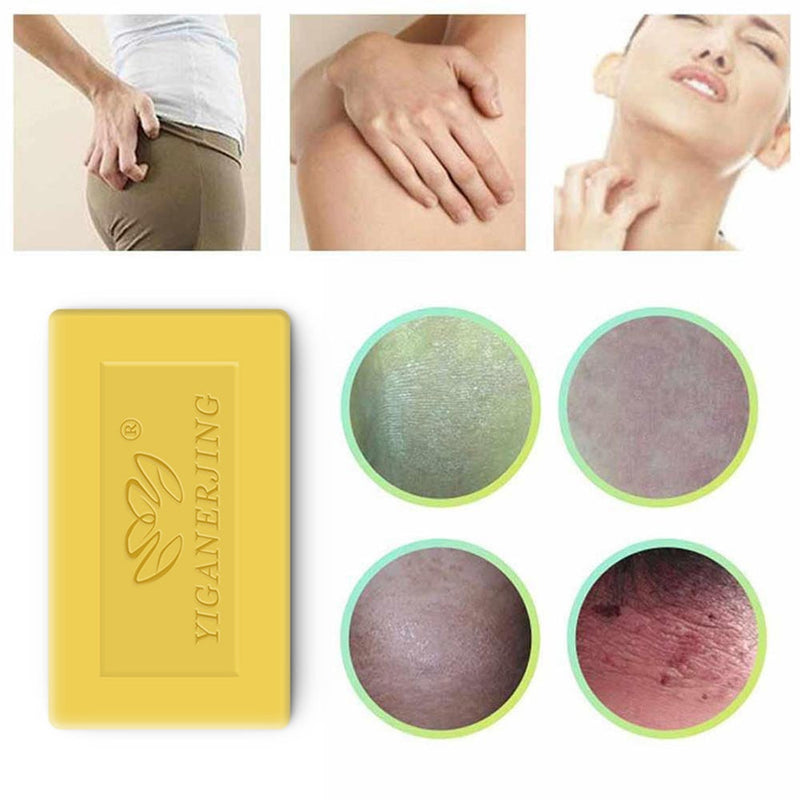 Anti Acne Soap Acne Treatment