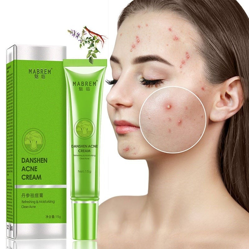 Anti-Acne Face Gel Care