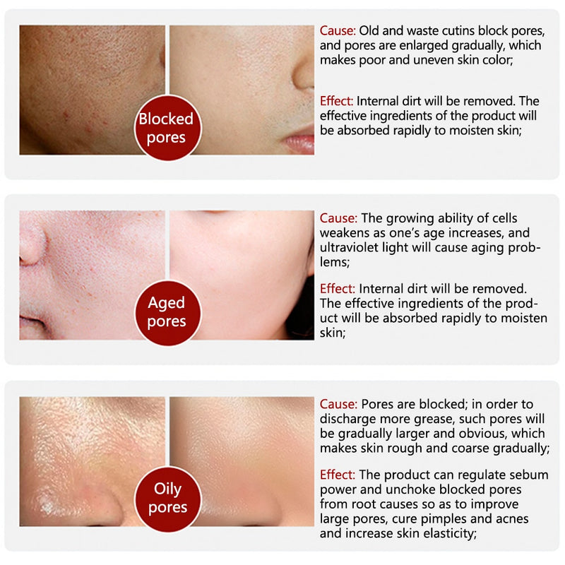 Repair Face Pores Treatment