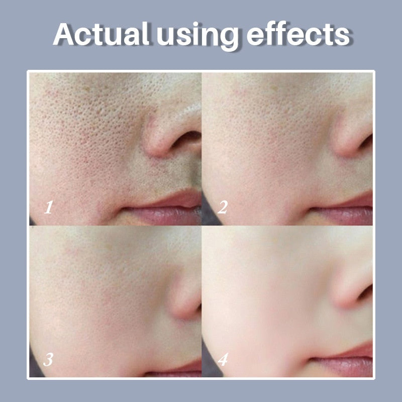 Repair Face Pores Treatment